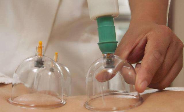 02此外,拔火罐还有助于排出体内的毒素和废物,在拔罐的过程中,皮肤