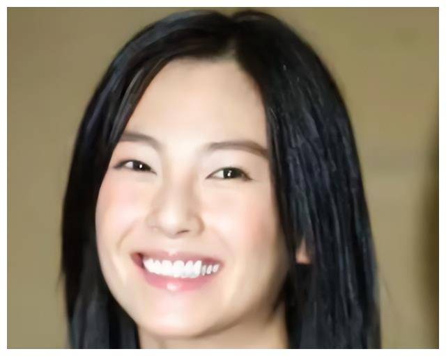 相比于单眼皮时期,双眼皮使得张雨绮的眼睛更有气质,为整个面部增添了