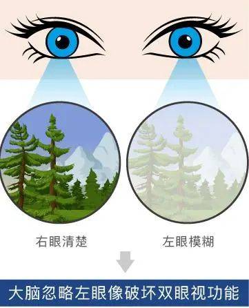 双眼近视度数相差大竟会有这些危害