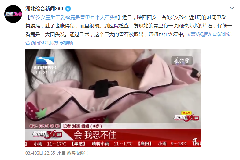 到医院检查,医生发现她的胃里有一块网球大小的结石,仔细一看竟是一大