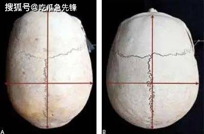 左:蒙古人种,纵深长,颧骨平右:高加索人种,纵深短,颧骨突通过化妆修容