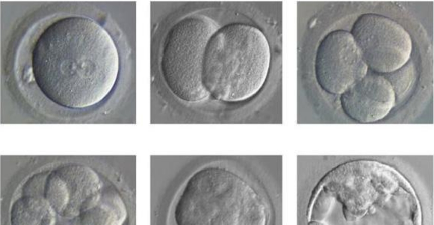 试管婴儿胚胎级别和囊胚等级划分