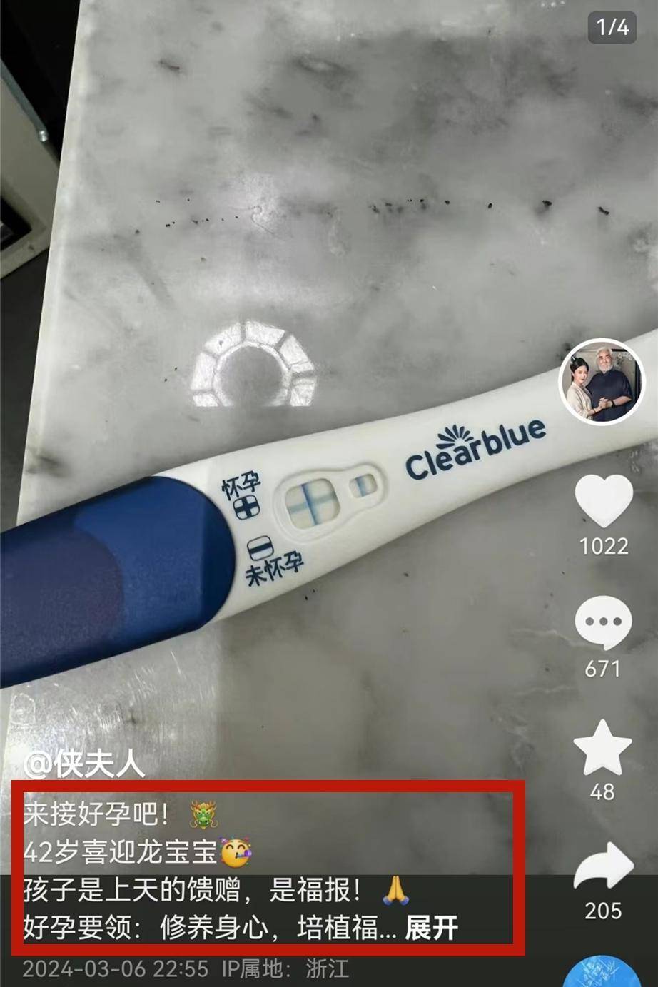 42岁娇妻杜星霖官宣四胎,晒彩超已怀孕50多天_樊馨蔓_孩子_马丁