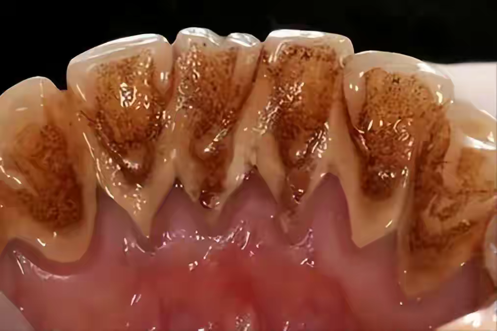 黏牙 来自搜狐网