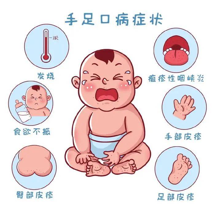 发病_症状_流感