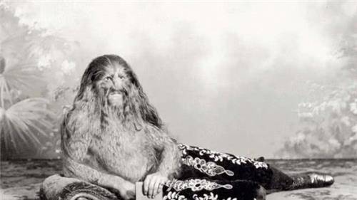 原创欧洲真实的半狮半人加入马戏团后走红成百万富翁结局如何