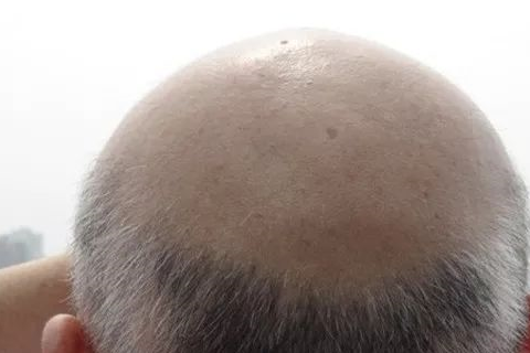 教你3个简单动作自测是否脱发