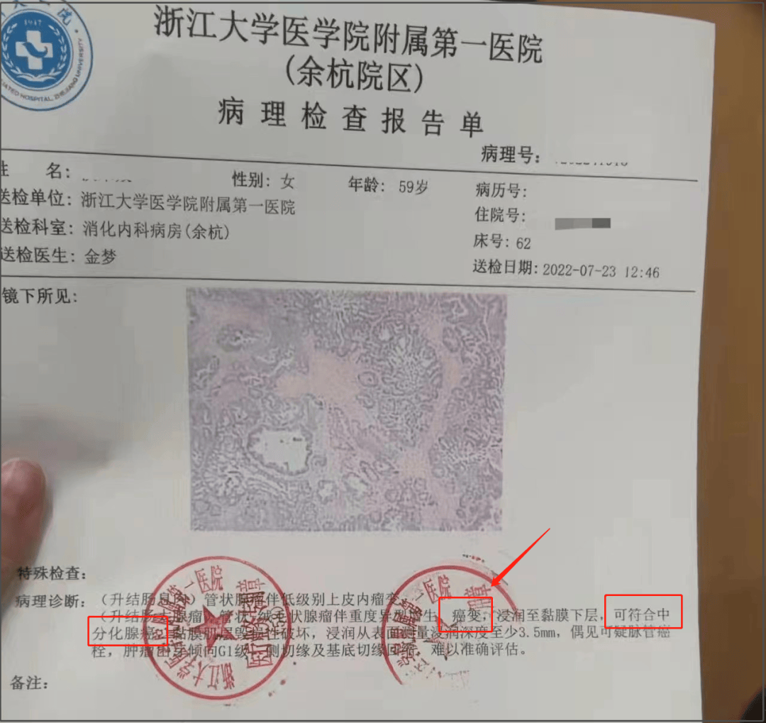 在奶奶不晓得的情况下，他们帮她杀掉了尿毒症(图3)