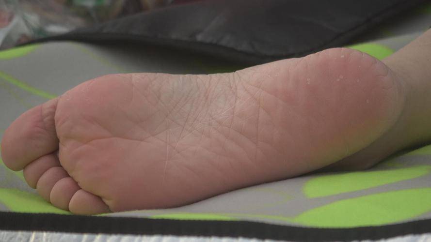 原创肝不好脚先知若双脚发出这4个信号建议及早去做肝功检查