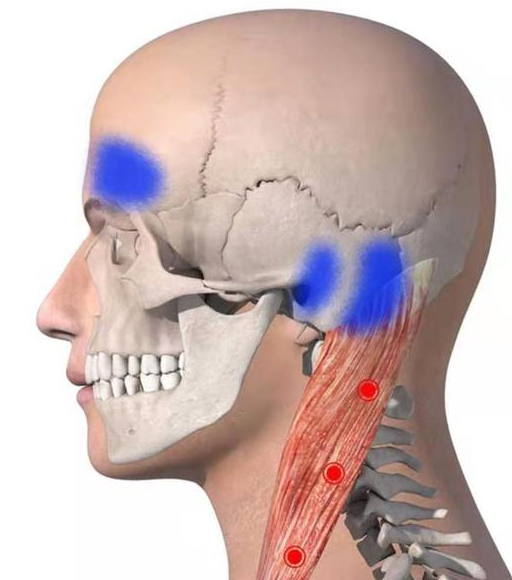 原创他有颈椎病头痛像戴着紧箍咒一个老头教他头画凤凰