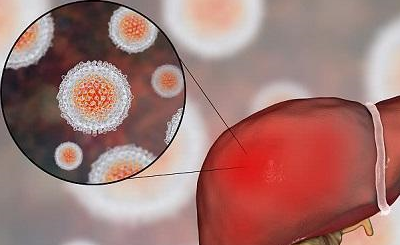 原创这种野草能治愈肝炎肝硬化腹水每天一棵就行连医院都在用