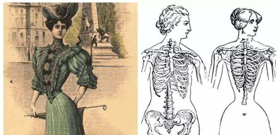 的西方医疗体系,"放血灌肠"都能是先进医疗手段了,自然也意识不到束腰