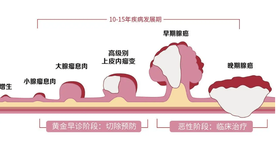 自查 上厕所出现4种怪象