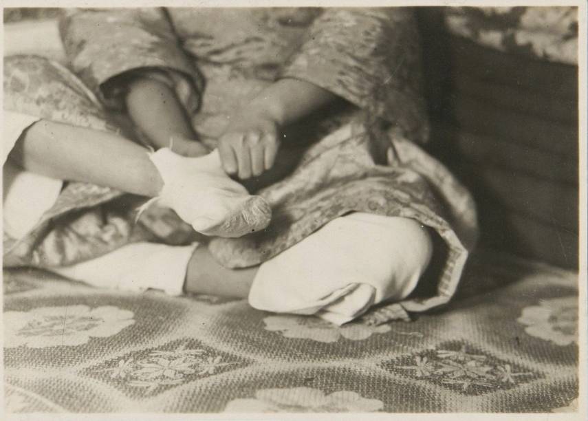 原创日本人1932年拍摄的妇女裹脚照片展现妇女裹脚的真实情景
