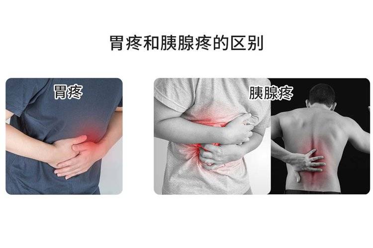 腰疼查出胰腺癌