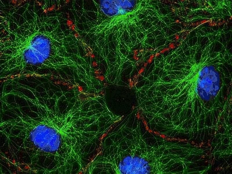 人类衰老是dna的衰老还是细胞的衰老