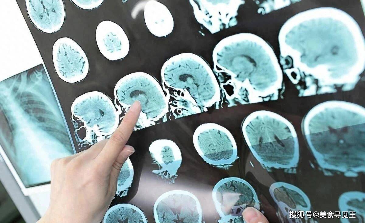 其中分布着很多由神经细胞集中而成的神经核或神经中枢,例如有端脑