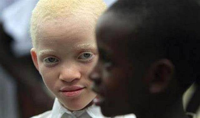 原创非洲版唐僧身体被人觊觎血液堪比黄金遗骸能卖上百万