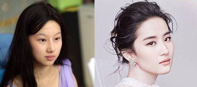 原创原创19岁女孩花百万整成刘亦菲名字也改一样如今怎样了