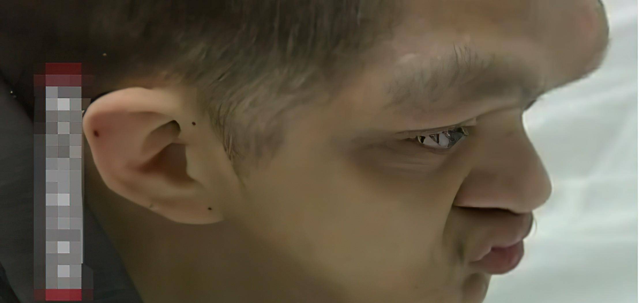 2007年,湖南小伙长相怪异如"猴人",爬行树林间智力仅2岁_陈聪_华的