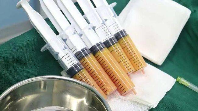 脂肪张凤余谈维密丰胸到底怎么样