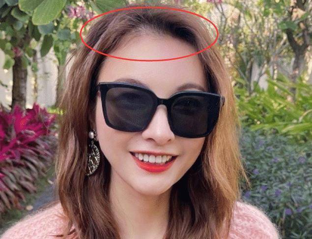 原创吴昕晒度假照戴大墨镜星味十足38岁发际线上移扎心了