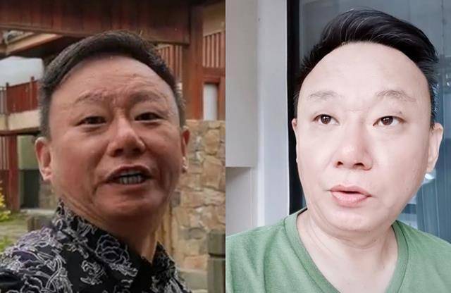 原创52岁小品演员邵峰罕见露面满脸坑洼不平太吓人头发花白显憔悴