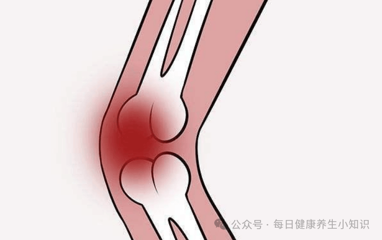 走路时膝盖突然软一下别以为是累了或许是这些疾病的信号