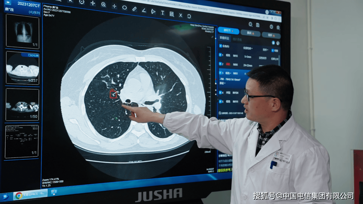 健康云检，便捷医疗新力量？！90%覆盖，700万人次受益，AI让温州市医疗服务升级！