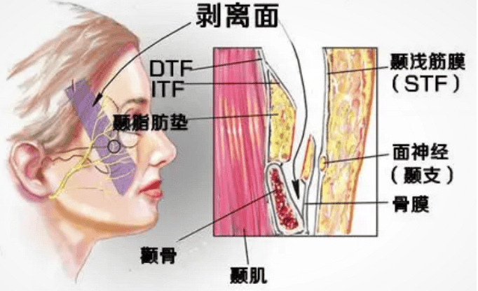 面部筋膜韧带图片