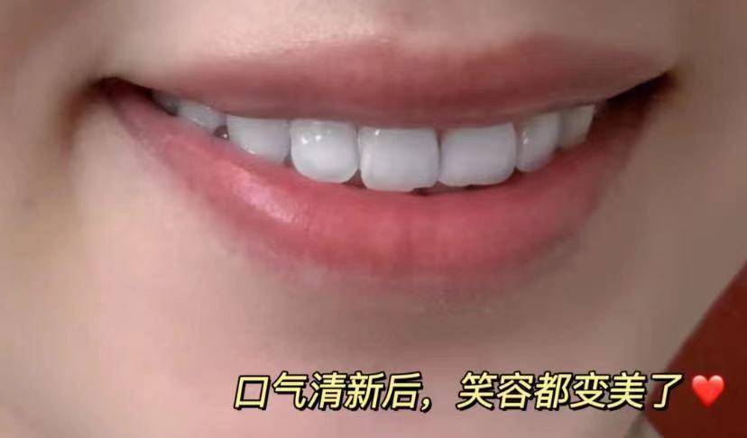 口水粘腻拉丝口臭熏人三个妙招不妨一试从此告别口臭尴尬