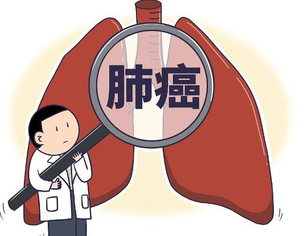 肺癌都是"拖"出来的?医生:身上的"两痛"建议检查!