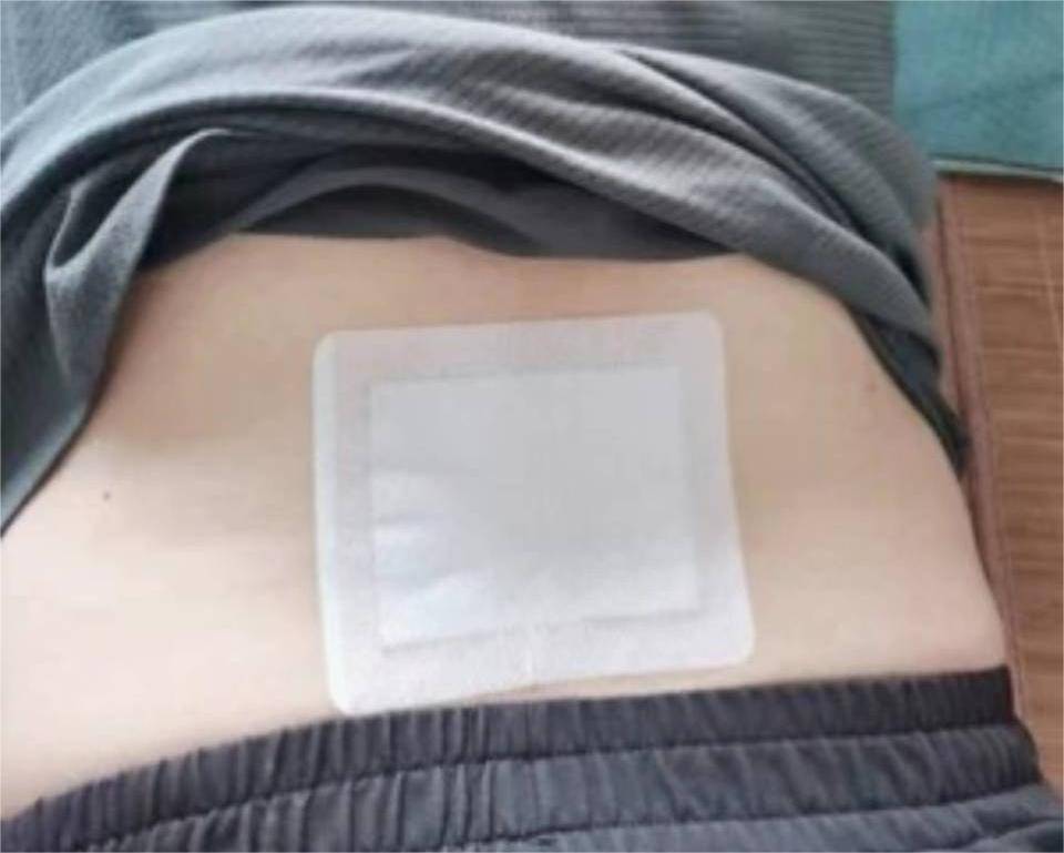 太强大了!只需4招就能解决腰突!99%患者都说有用!