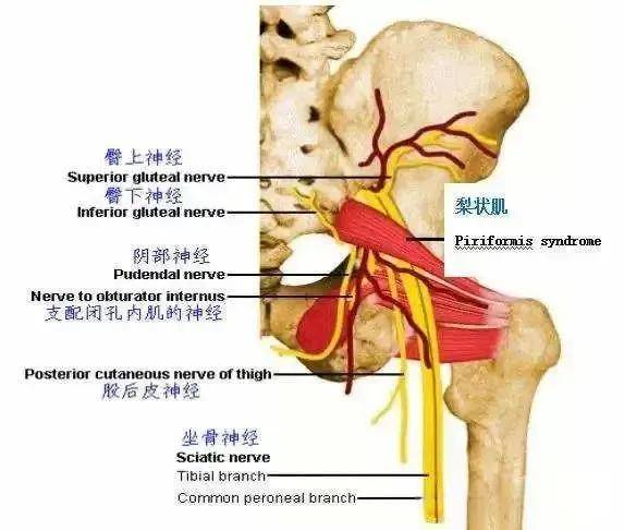 梨状肌松解图片