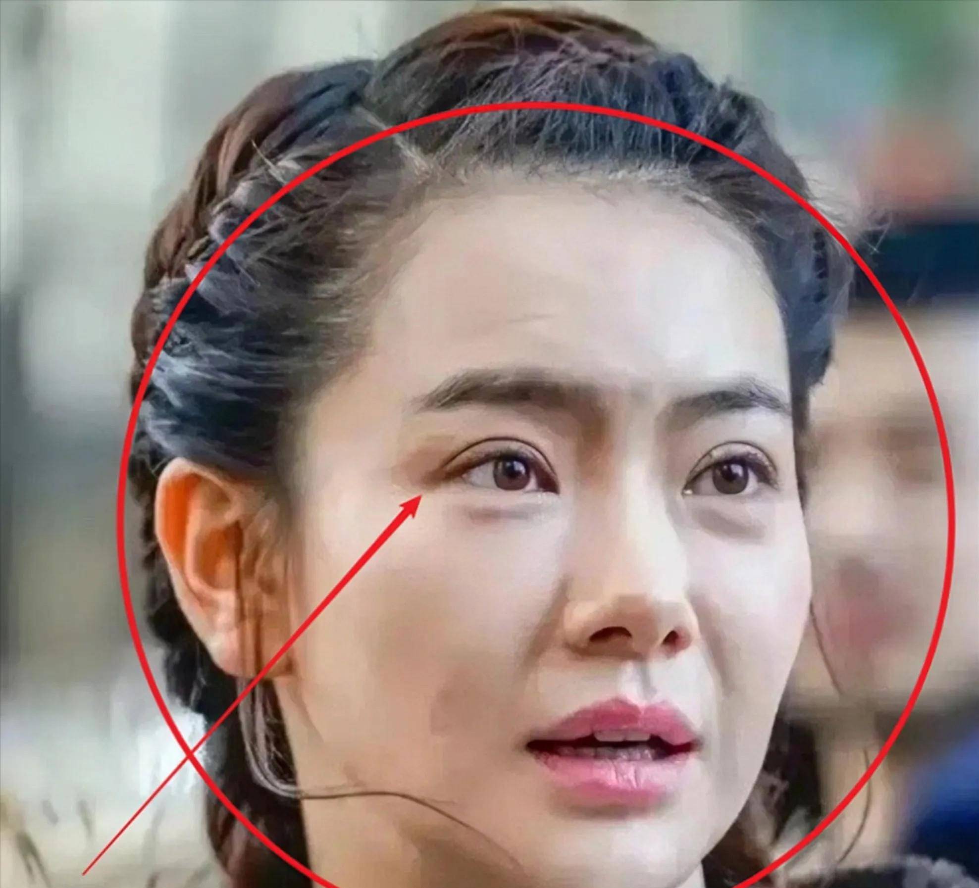 戚薇的脸上多次被发现do过了的痕迹,大概因为早期做过磨骨手术,她的