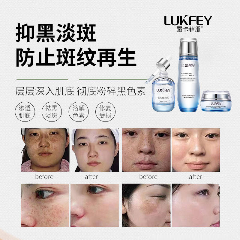 美白祛斑抗衰老提亮护肤品排行榜评选淡斑祛斑效果排名第一护肤品