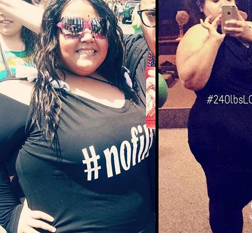 原创400斤女孩胖到无法站立3年甩肉260斤美的连妈都不认识了