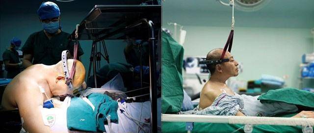 原创折叠人李华骨头敲断4次植入22颗钢钉28年后重新学走路