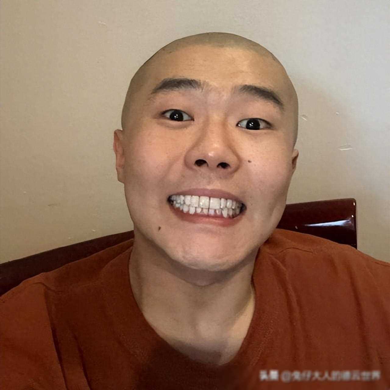 德云社周九良晒光头照引师兄弟欢笑人缘爆棚