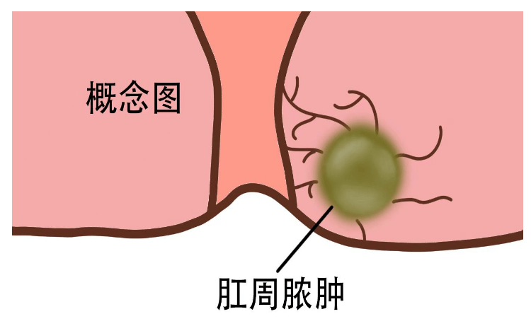 下面流脓图片图片