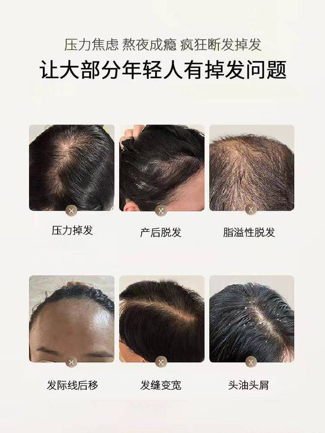 国内防脱洗发水哪个牌子的效果好秃头姐妹做好笔记