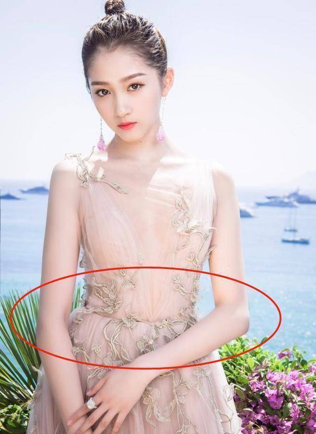 原创关晓彤故意的吧继7个指头生西瓜后又整出白癜风和变异