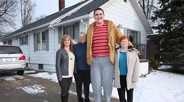 原创载入史册的奇男子21岁以前患侏儒症21岁后患巨人症享年51岁