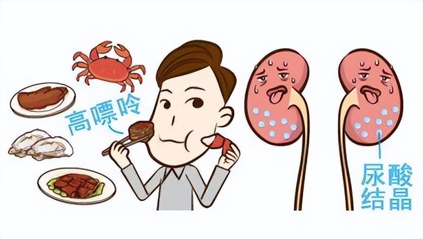 了解难治痛风的三个阶段高尿酸是引起痛风的根本原因