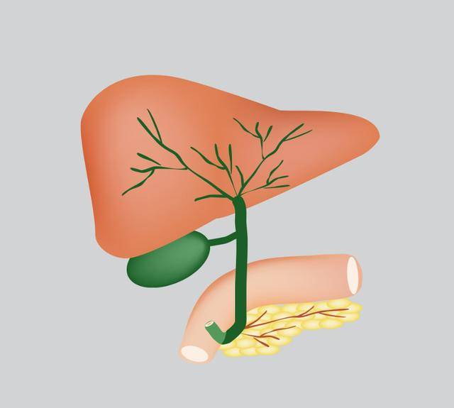 原创人没了胆囊身体会有啥变化呢3种疾病或会找上门能不切别切