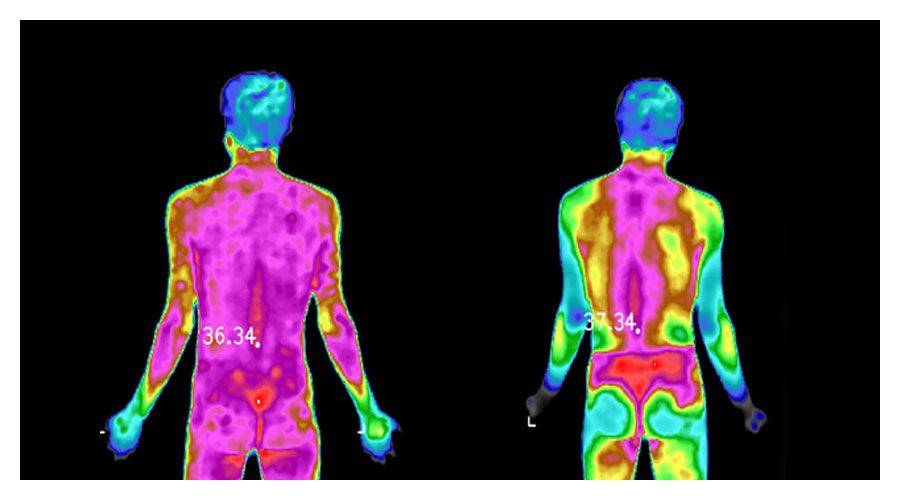 红外热成像及时预警疾病信号_技术_病变_人体