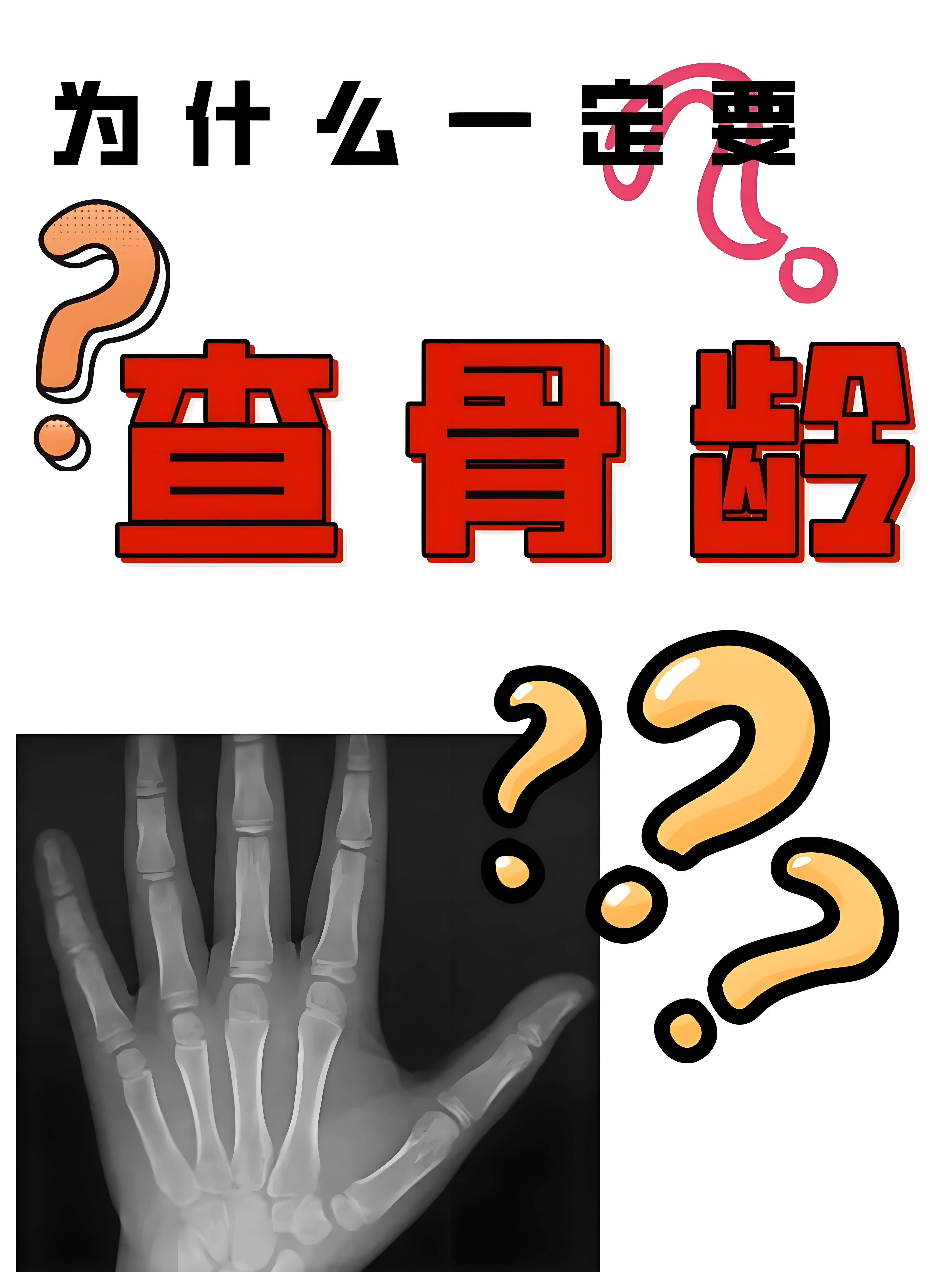 骨龄检测,即骨骼年龄测定,是通过拍摄左手手腕部位的x光片,观察骨化