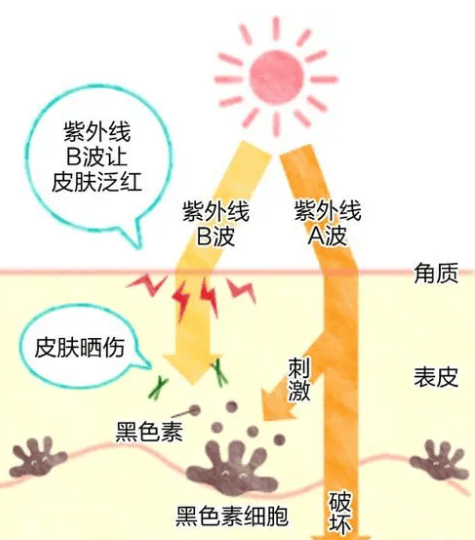 紫外线_肌肤_色斑