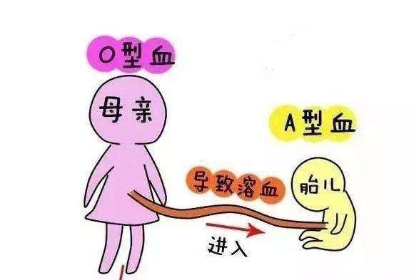 葡萄胎图片卡通图片图片