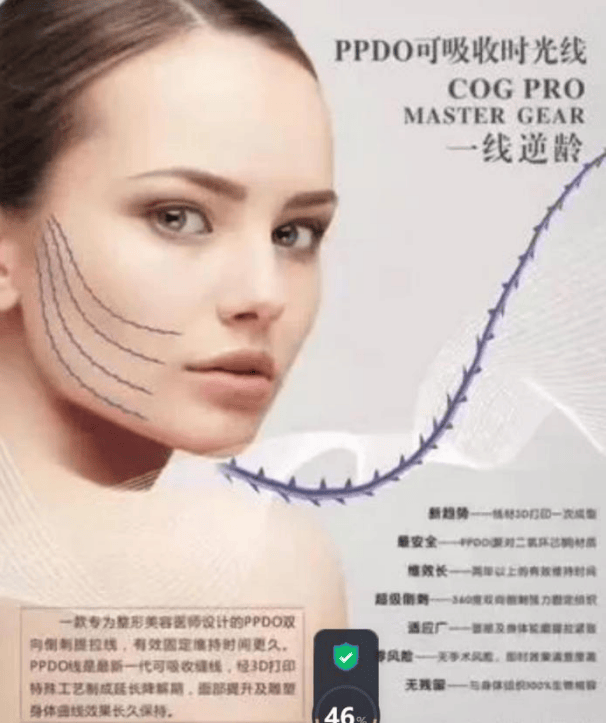 线雕多久可以恢复自然?埋线提升面部可以维持多久谁说了算